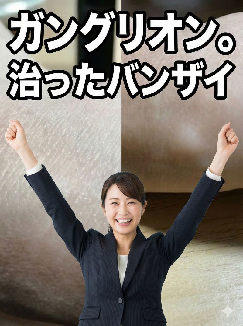 半年前に、右手首にガングリオンができた話を書きましたが、どうやら経過観察のうちに膨らみがきれいに消えてくれたようです。